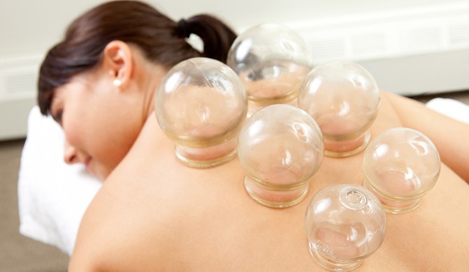 Cupping therapy is another treatment that can relieve the aches and pains that come along with an active lifestyle and an againg body. Photo: Shutterstock