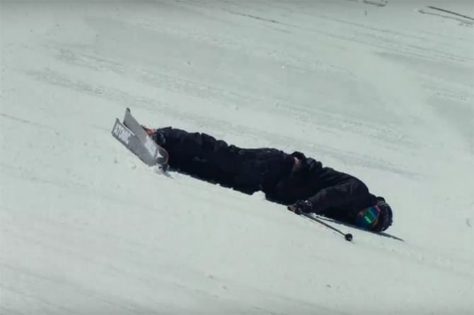 Gus Kenworthy, after a wreck in Telluride last spring.