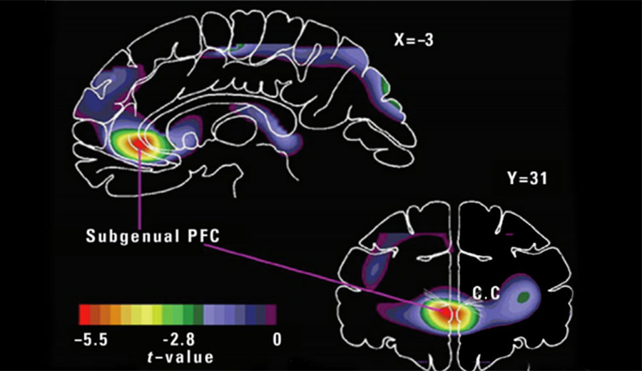 Scientists recently studied the physical effects that nature has on your brain. 