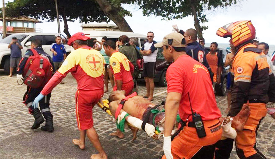 Pablo de Melo had to have his leg amputated after he was mauled by a shark in Brazil. Image: NYPost/FocusOn News