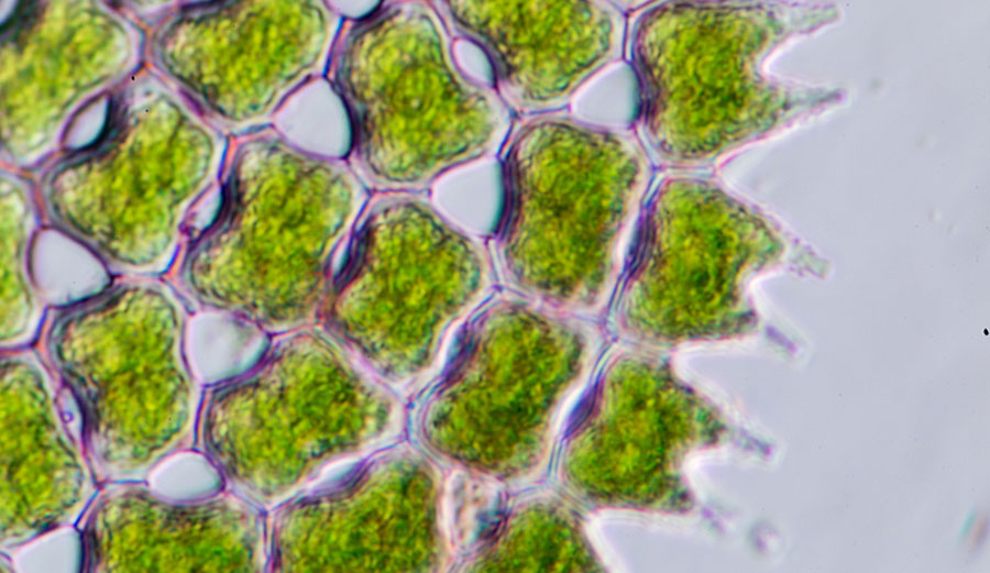 Phytoplankton under a microscope