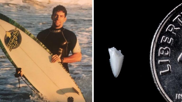 Flagler Beach, 1994: Jeff Weakley was out surfing while attending a college beach party when he felt a sudden, sharp bite to his foot that couldn't have been anything but a shark, he thought. The fish shook his foot repeatedly, leaving him with several deep lacerations. Like most surfers, Weakley valued water time over the tiny chance of another run-in with a shark. Within a couple of weeks, he was back in the ocean with his foot wrapped in a waterproof bandage and covered with booties. Nearly twenty-five years later he noticed a blister forming on his foot. Turns out it was a tooth left from the attack that had finally festered to top of his skin. He removed it and planned to make a pendant from it but changed course when he learned that the Florida Program for Shark Research had identified a shark species through DNA after a bite off the New York coast and decided to have the tooth analyzed. “I was very excited to determine the identity of the shark because I’d always been curious,” Weakley told the Florida Museum of Natural History. “I was also a little bit hesitant to send the tooth in because for a minute I thought they would come back and tell me I’d been bitten by a mackerel or a houndfish – something really humiliating.” But he didn't need to worry. Scientists identified the shark through DNA as a black tip, which Weakley had suspected. When he was bitten at 21 years old, he remembered the water being filled with mullet and had a suspicion black tip were feeding on the baitfish. Today, Weakley, who edits Florida Sportsman magazine, still surfs but tries to avoid areas where baitfish are prevalent. And he has no ill-will towards any species of shark, though. “I’ve been lucky not to have been bitten by a dog, but I would regard that interaction I had with that shark as being no different or more destructive than a dog bite,” he said. “I certainly don’t have a hatred of sharks or any feeling of vindictiveness toward them. They’re part of our natural world.” You can read the full Florida Museum of Natural History report, here.